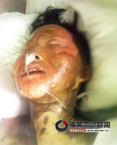 江西抚州强拆钉子户爆发冲突 3人自焚重伤(图)(7)