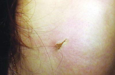 女子KTV里拿起话筒唱歌被电得浑身抽搐(组图)